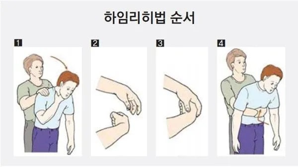 아이가 있는 가정에서 꼭 알아야 할 하임리히법 관련 사진