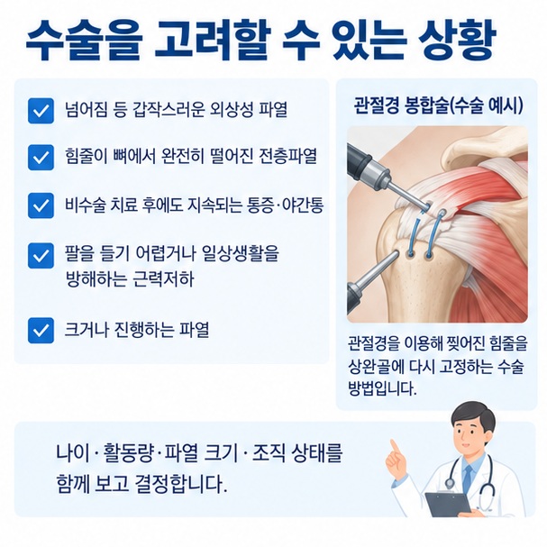 외상성 파열 완전파열 지속 통증 근력저하에서 수술을 고려하는 기준과 관절경 봉합술을 보여주는 이미지