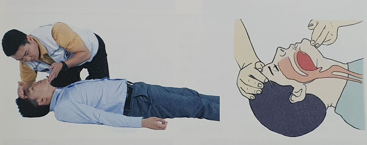 응급처치 심폐소생술(CPR)과 기도폐쇄 하임리히법
