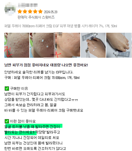퍼델 우레아크림 리뷰와 후기 사진