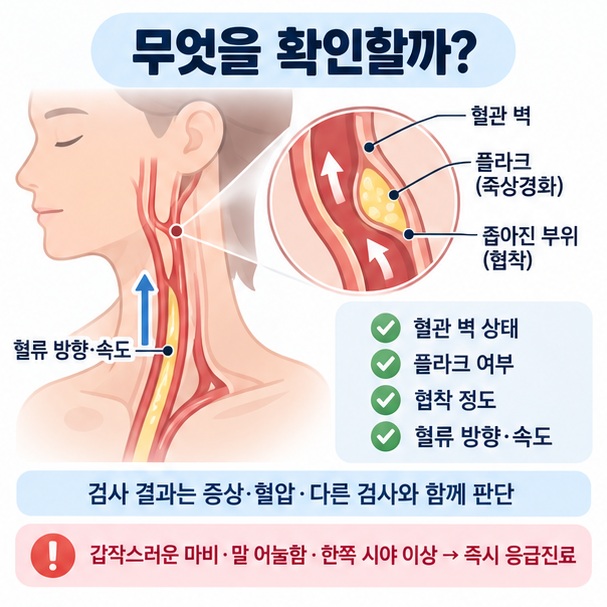 경동맥 초음파로 혈관 벽 플라크 협착과 혈류를 확인하는 검사 내용 인포그래픽