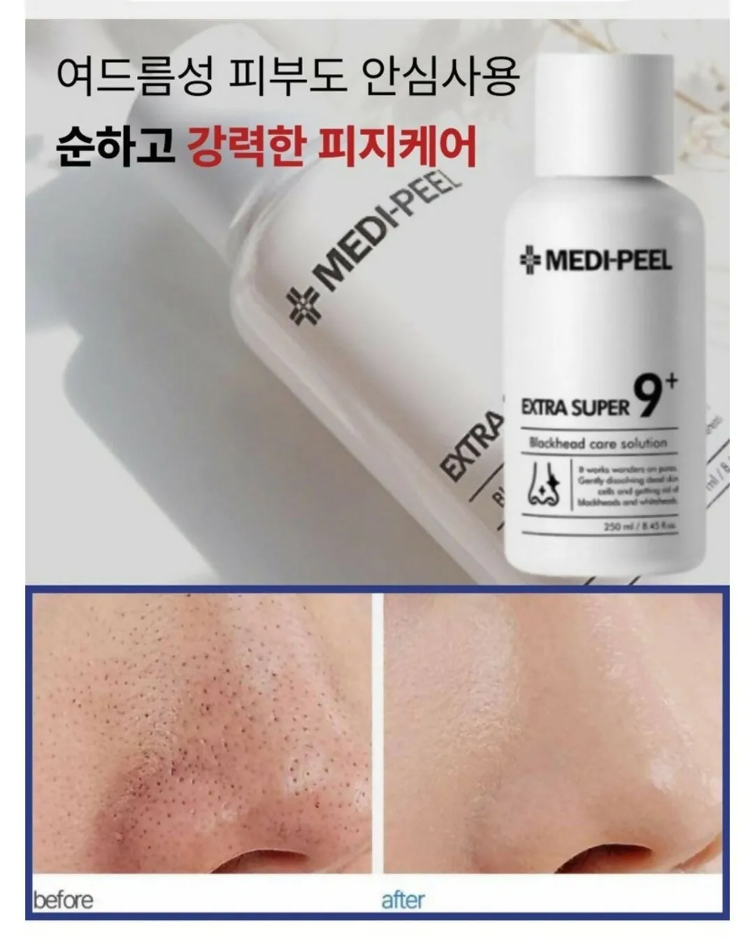 남자 얼굴 피지 제거 화장품 꿀템_5