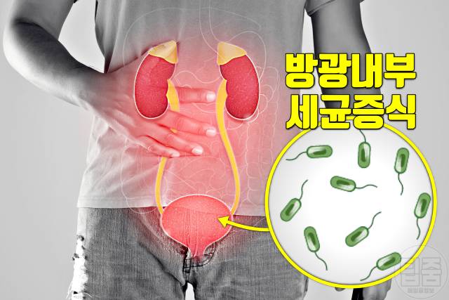 신장 나쁜 습관 신장에나쁜음식 신장에나쁜약 신장에나쁜운동