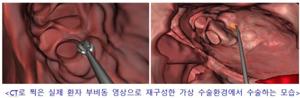 축농증수술