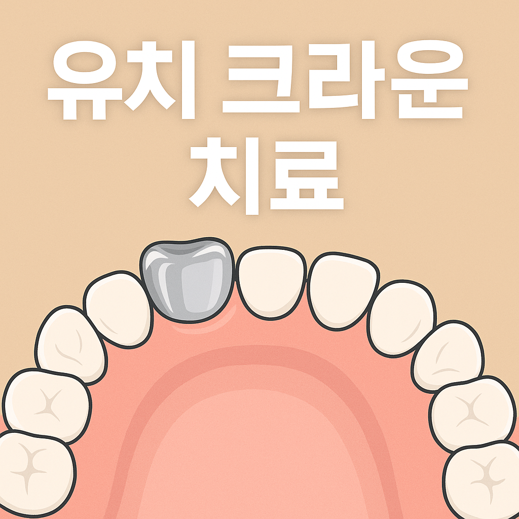 유치 크라운 치료 가이드