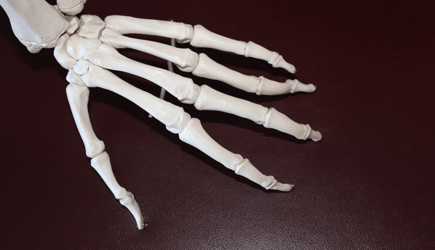 손이 붓는 이유가 될 수 있는 관절염의 손 모양의 뼈 형체