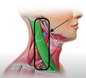 목주름-없애는-법
