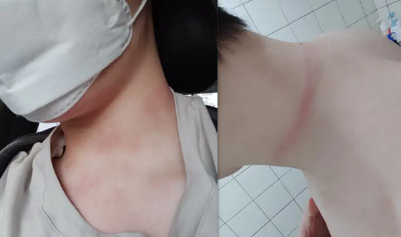 묻지마 폭행 당했는데 피해자를 범죄자로 만든 경찰