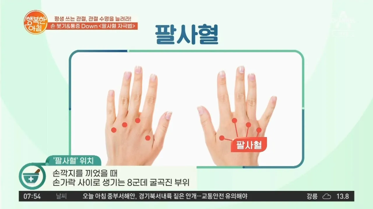 손등 붓는 이유 혈액순환 문제 증상과 해결법 정리_8
