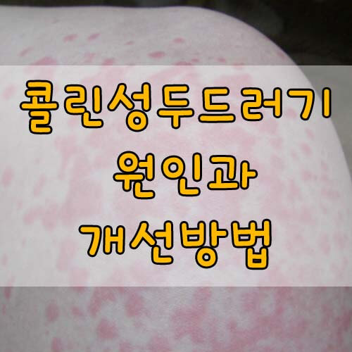 콜린성 알레르기, 콜린성 두드러기 완치, 원인과 개선방법 총정리!