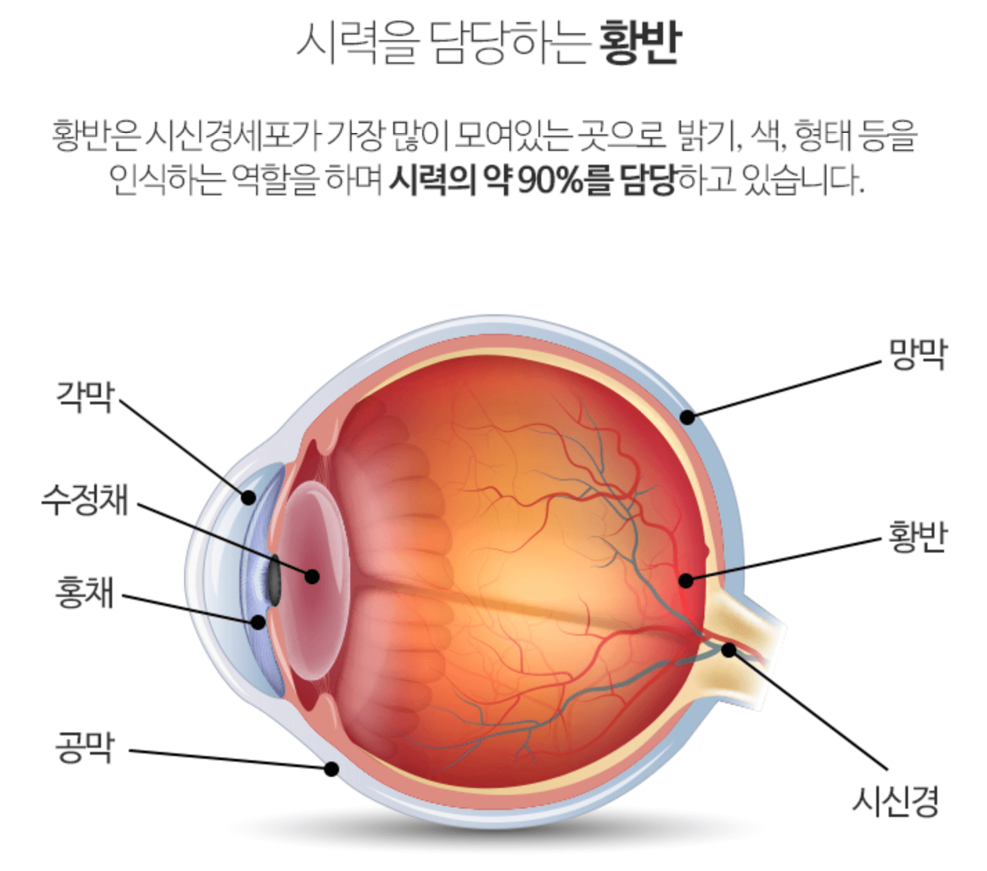 황반