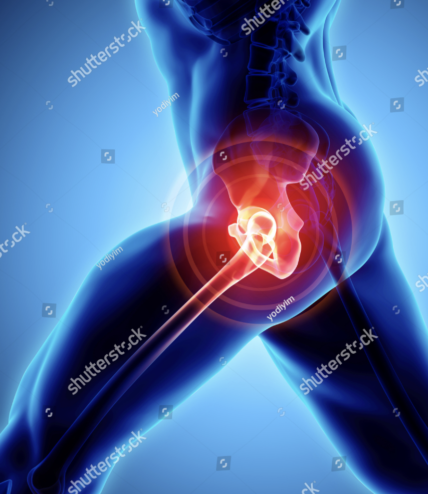 고관절 통증 원인 관련 이미지