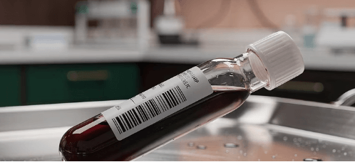 비타민d 하루권장량