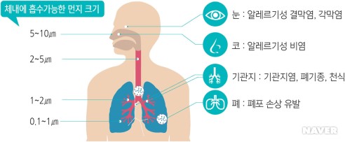 미세먼지 황사 예방