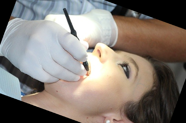 잇몸 내려앉음 치료