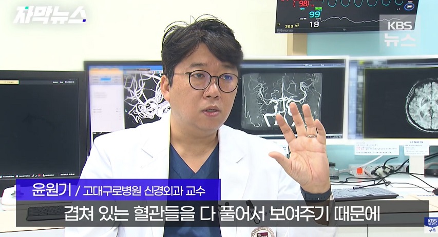 윤원기-교수-뇌혈관3D모델