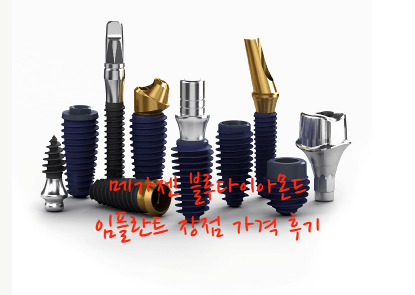 메가젠 임플란트