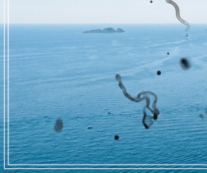 눈 검은것이떠다니는것