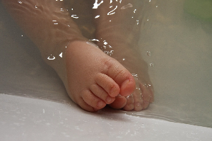 무좀 원인, 치료법