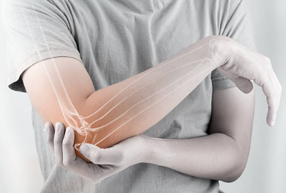 골다공증 증상, 수치, 골다공증에 좋은 음식 총정리 (2024ver)