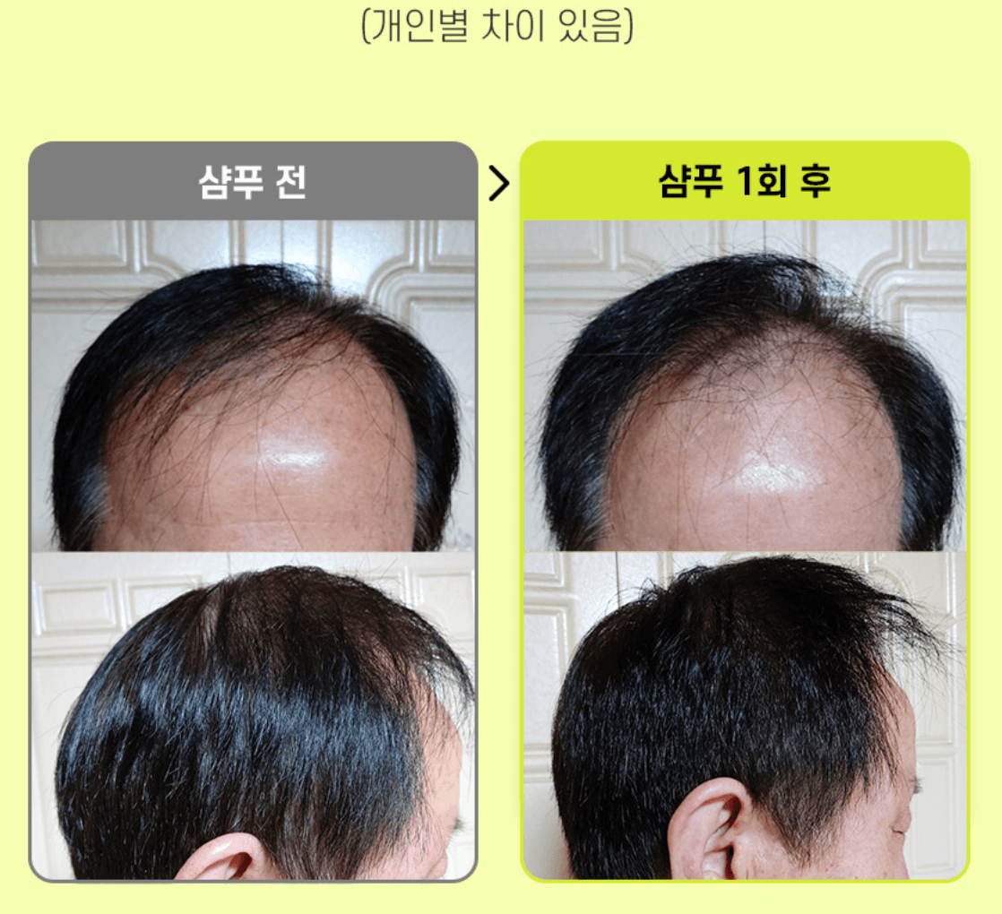 그래비티 탈모 샴푸 후기