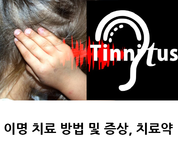 이명 치료 방법 및 증상 , 치료약