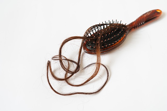 청년탈모치료지원