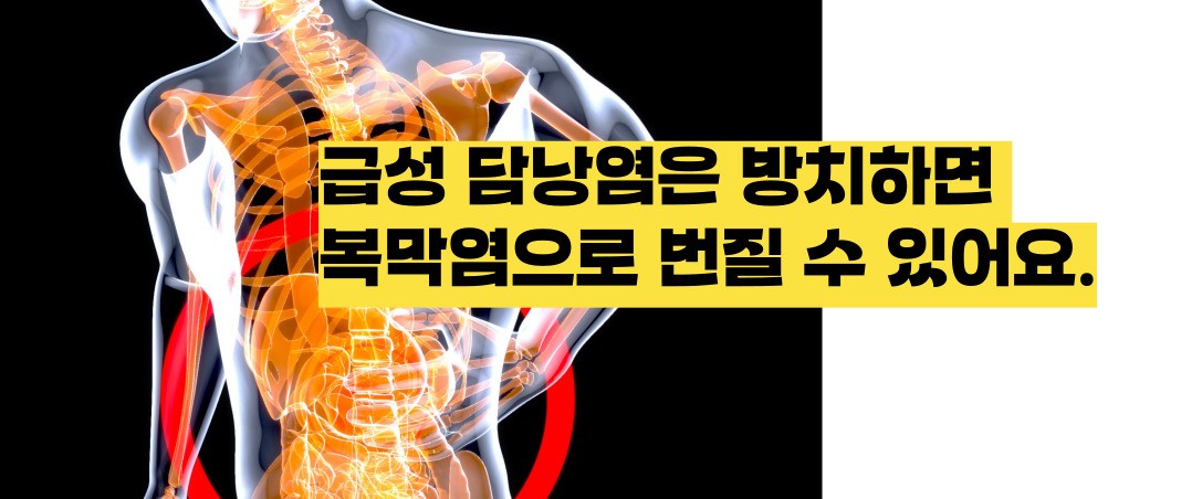 담낭염 증상