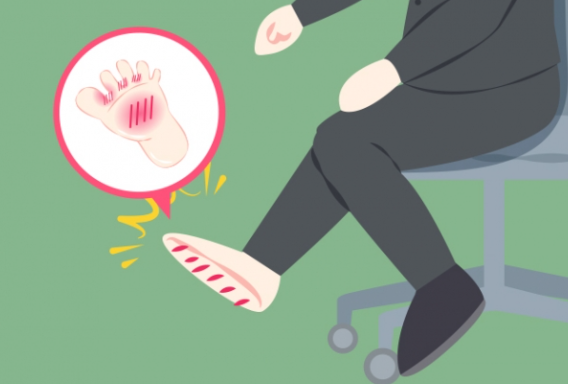 무좀 증상별 무좀약 추천