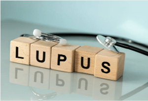 루푸스