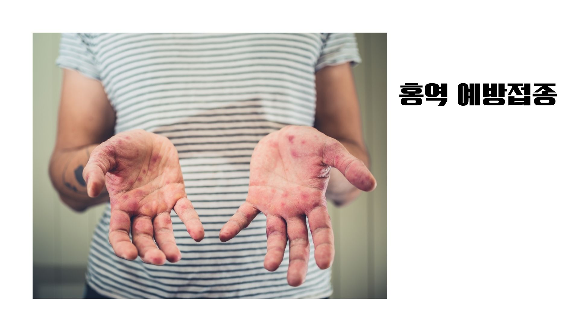 [경험담] 베트남 여행 전 보건소 홍역 예방접종 직접 다녀온 후기