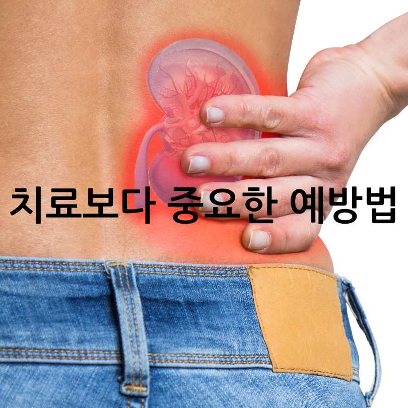 남성 방광염 원인과 증상, 자가치료법
