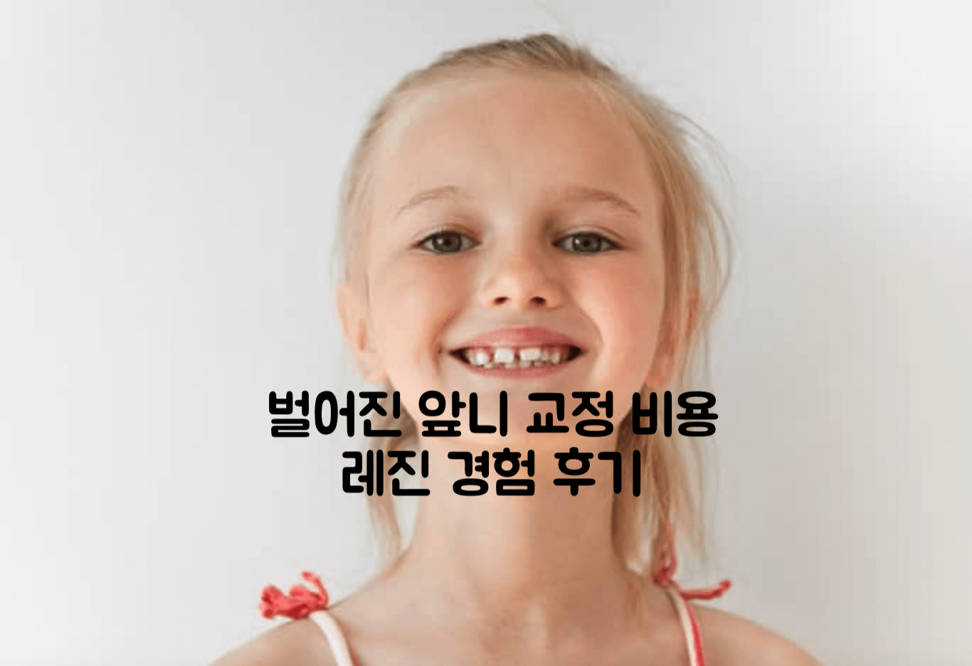 벌어진 앞니