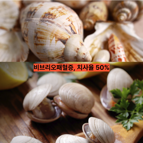 비브리오패혈증, 치사율 50%…올여름 어패류 섭취 전 꼭 알아야 할 예방 수칙