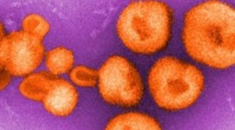 니파 바이러스 치료제