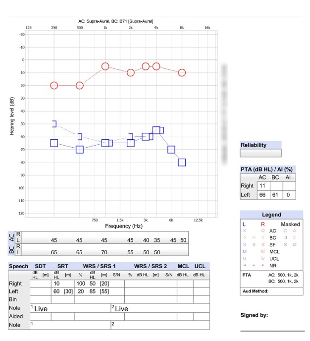 청력검사표입니다