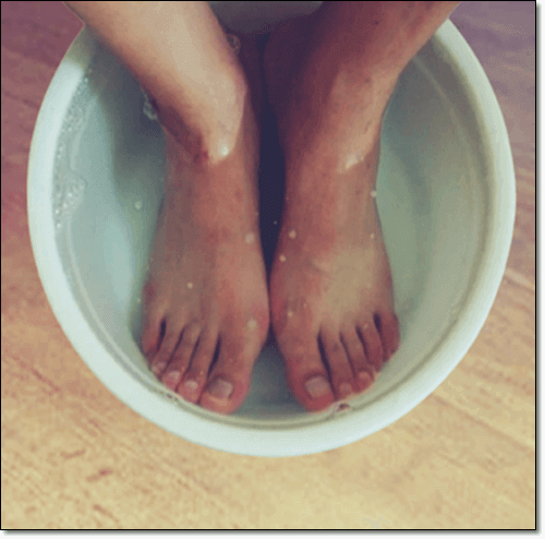 발등 붓기 치료