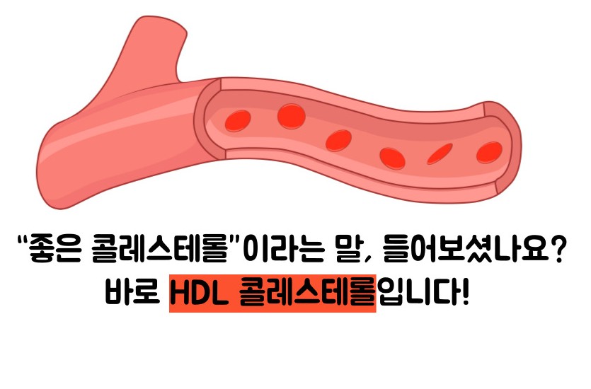 hdl콜레스테롤 정상수치