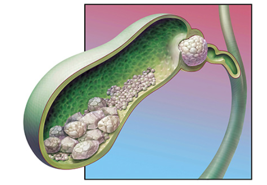 가슴-가운데-통증7