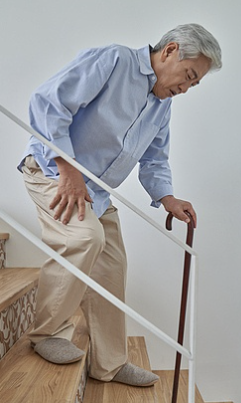 퇴행성관절염 증상 6