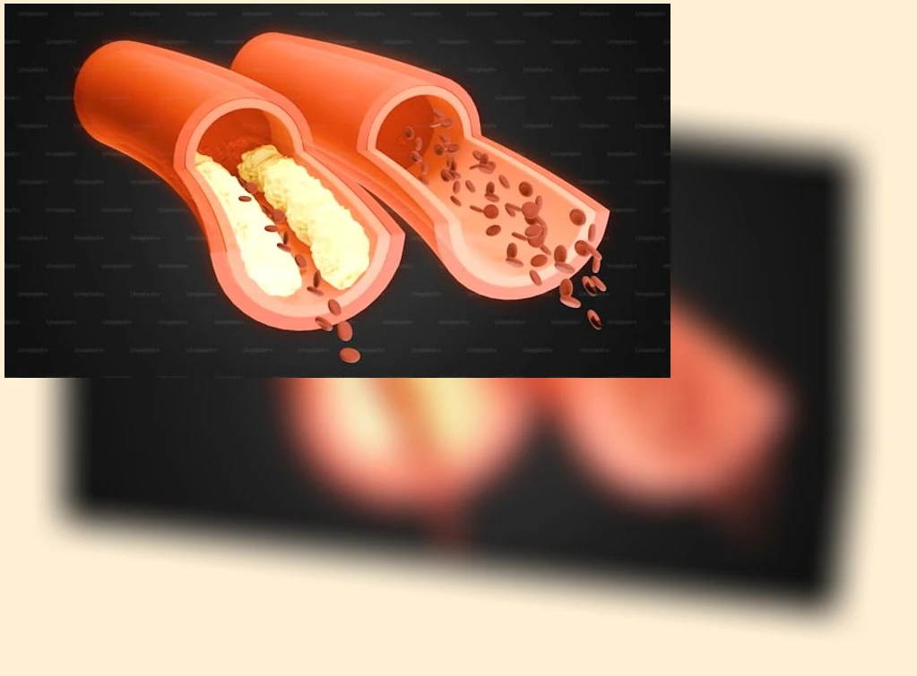 혈당 관리_3_subsection