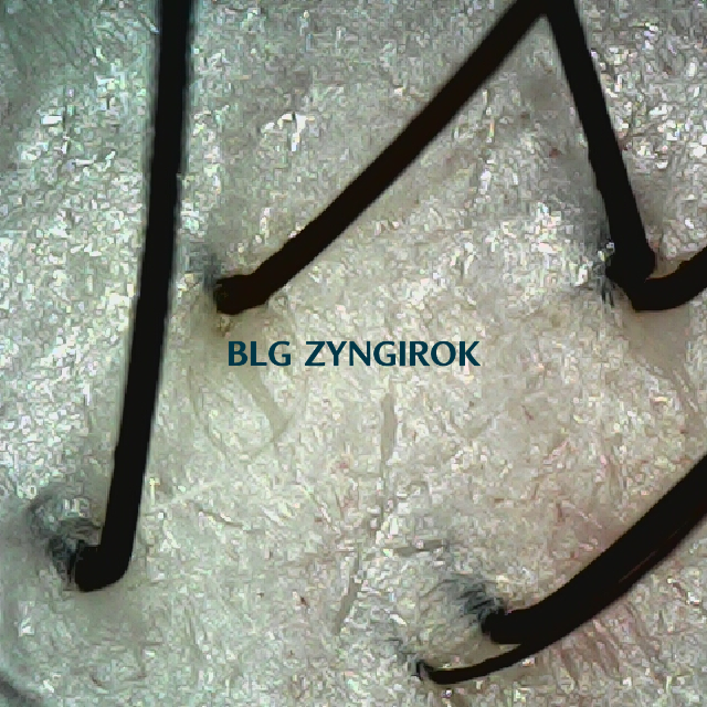 탈모 극복 프로젝트 - 뒷머리 두피 모습이다.