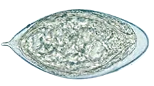 Schistosoma haematobium