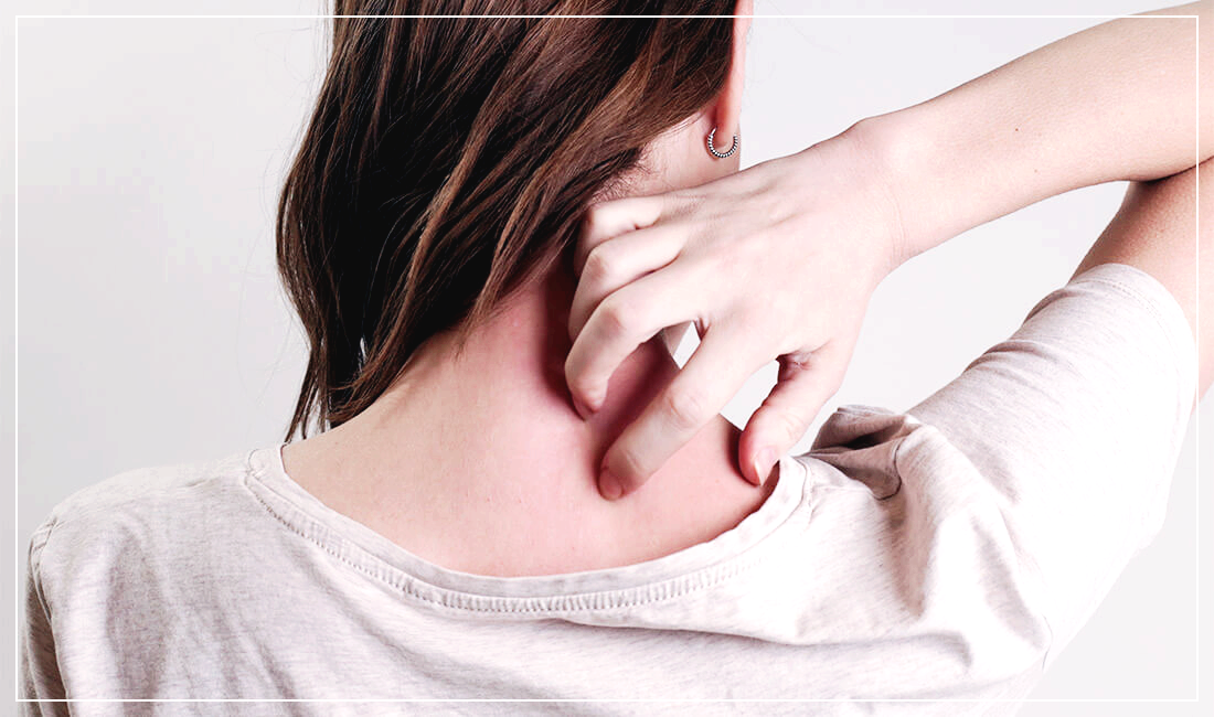 대상포진 예방방법