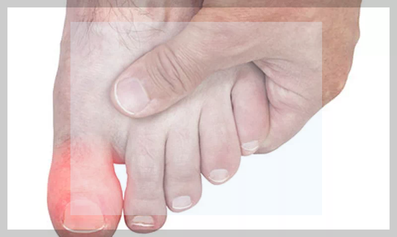 엄지 발가락 마디 통증