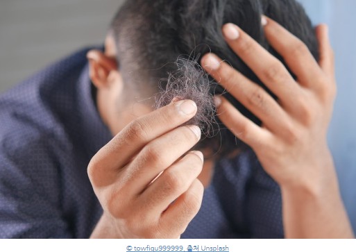 탈모로 인한 스트레스