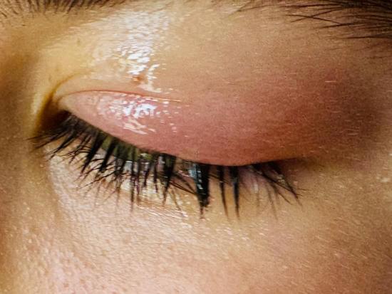 안과 질환 종합 가이드