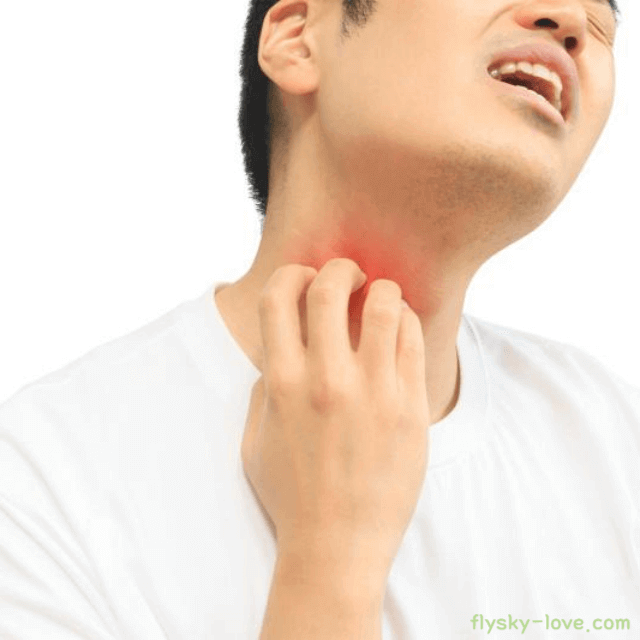 피부가 울긋불긋 두드러기 증상