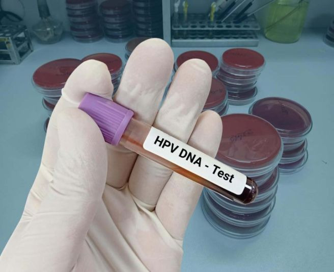 hpv 바이러스 남성 무료 접종 확대 시기: 가다실 9가 전환 가능성 분석, 남자 자궁경부암 백신 4가 9가 차이 비교