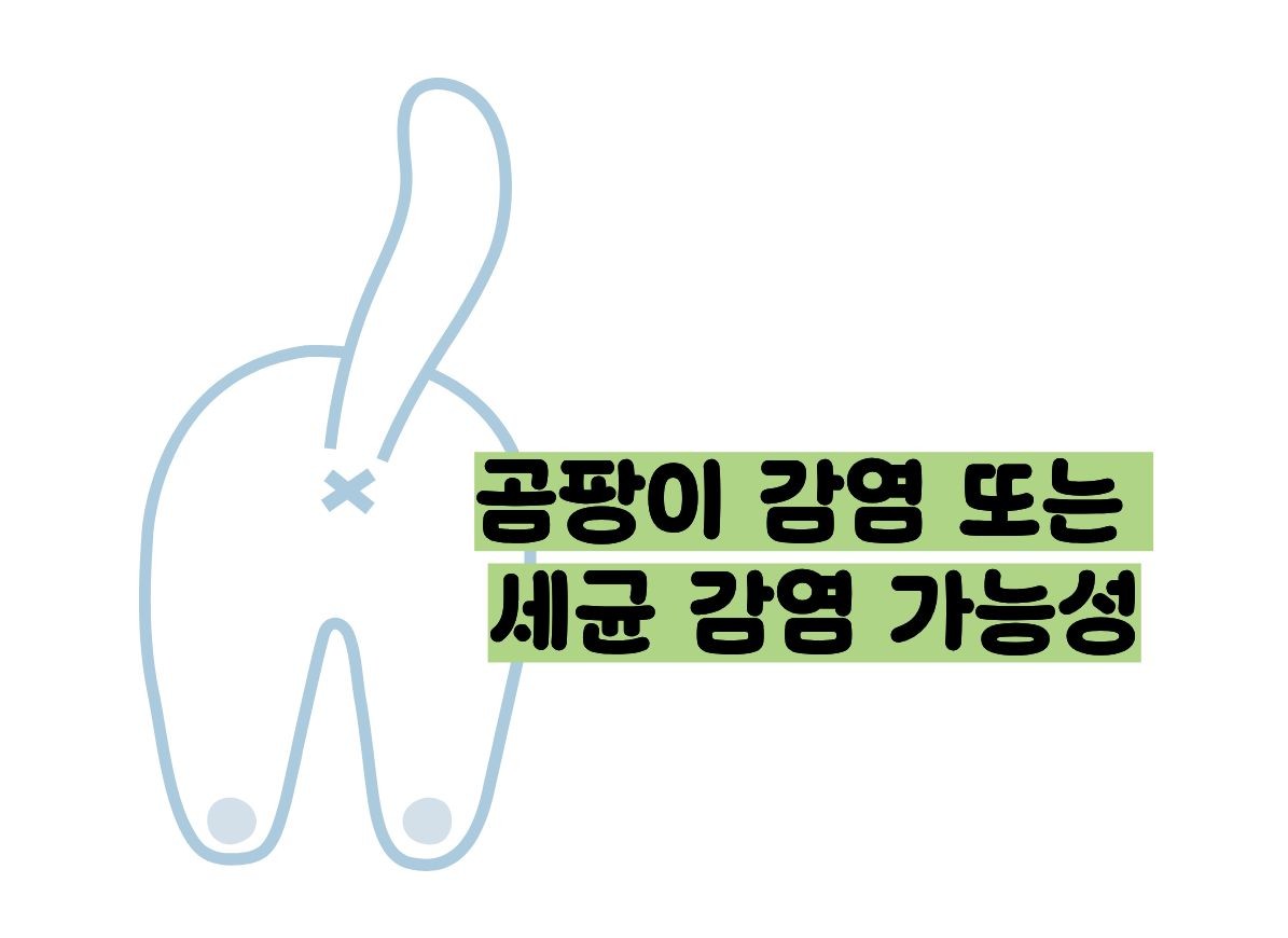 항문 가려움증 원인
